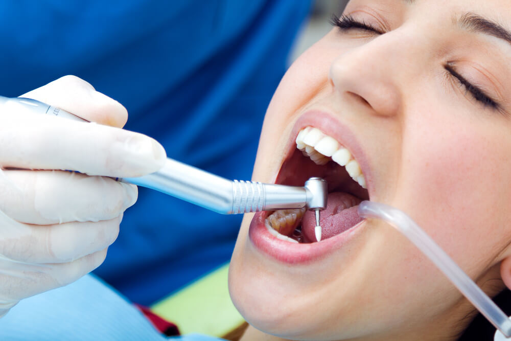 Endodontics ss